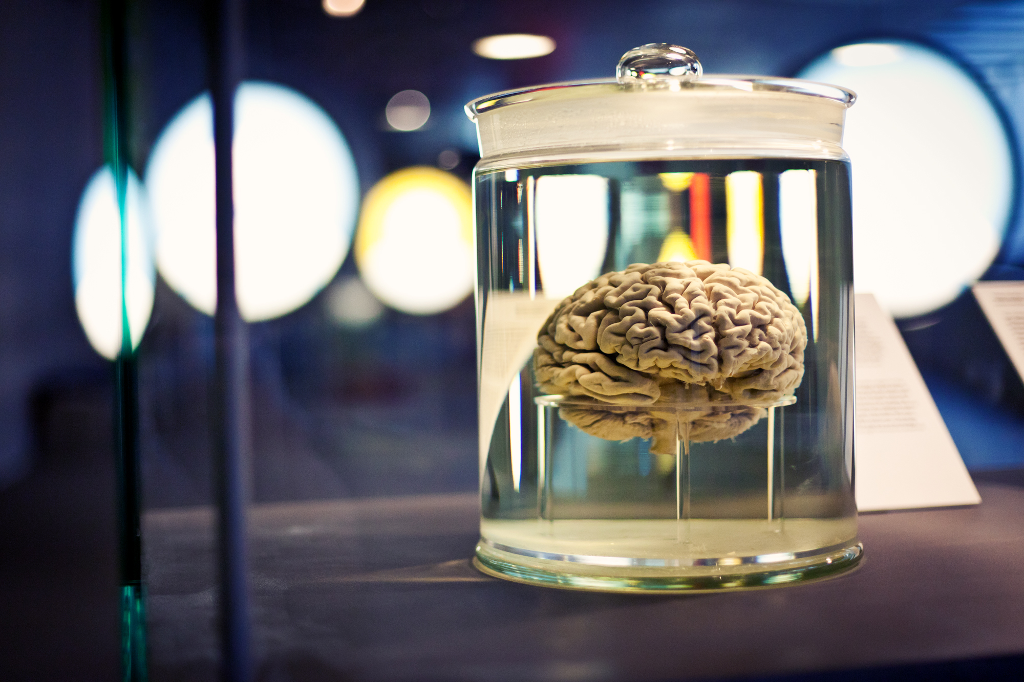 Menschliches Gehirn im Glas